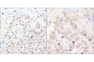 anti-Cleavage and Polyadenylation Specific Factor 2, 100kDa (CPSF2) (AA 450-500) antibody