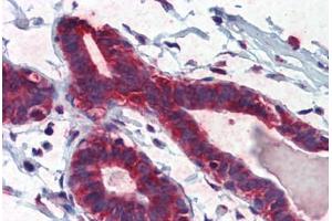 Human Breast (formalin-fixed, paraffin-embedded) stained with TBX5 antibody ABIN462189 followed by biotinylated goat anti-rabbit IgG secondary antibody ABIN481713, alkaline phosphatase-streptavidin and chromogen. (T-Box 5 抗体  (AA 174-223))