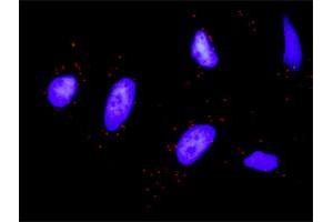 Proximity Ligation Analysis of protein-protein interactions between STAT1 and KIT. (KIT 抗体  (AA 41-140))