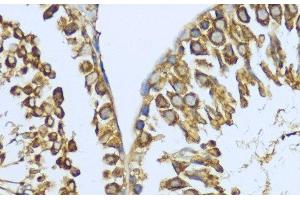 Immunohistochemistry (Paraffin-embedded Sections) (IHC (p)) image for anti-Heat Shock Protein 90kDa alpha (Cytosolic), Class A Member 1 (HSP90AA1) antibody (ABIN7256124)