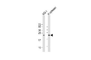 All lanes : Anti- LIF Antibody (Center) at 1:1000 dilution Lane 1: KG-1 whole cell lysate Lane 2:Human spleen whole cell lysate Lysates/proteins at 20 μg per lane. (LIF 抗体  (AA 72-101))