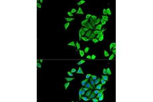 Immunofluorescence analysis of U2OS cells using KCNN3 Polyclonal Antibody (KCNN3 抗体)