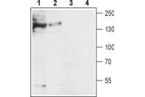 SLC8A1 抗体  (3rd Intracellular Loop)