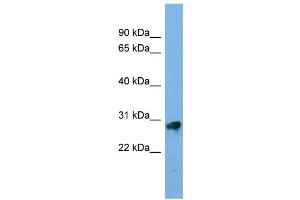 WB Suggested Anti-KLK13 Antibody Titration: 0. (Kallikrein 13 抗体  (Middle Region))