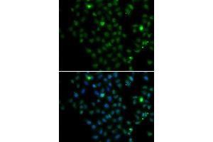 Immunofluorescence analysis of MCF7 cell using LMO4 antibody. (LMO4 抗体)