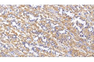 Immunohistochemistry (IHC) image for anti-Matrix Metalloproteinase 2 (MMP2) (AA 445-662) antibody (ABIN7430993)