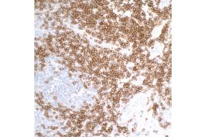 Immunohistochemistry (IHC) image for anti-CD27 Molecule (CD27) (AA 21-187) antibody (ABIN7455146) (Recombinant CD27 抗体  (AA 21-187))