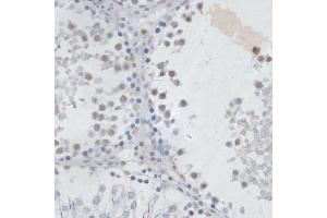 Immunohistochemistry of paraffin-embedded rat testis using USP7/HAUSP antibody (ABIN6132280, ABIN6150032, ABIN6150034 and ABIN6217614) at dilution of 1:100 (40x lens). (USP7 抗体  (AA 206-1102))