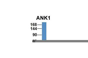 Host:  Rabbit  Target Name:  ANK1  Sample Type:  Human Fetal Liver  Antibody Dilution:  1. (Erythrocyte Ankyrin 抗体  (Middle Region))