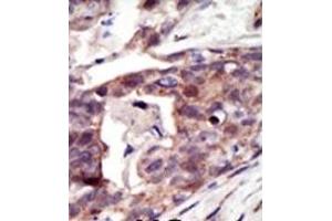 Image no. 2 for anti-Palmitoyl-Protein Thioesterase 1 (PPT1) (N-Term) antibody (ABIN357783) (PPT1 抗体  (N-Term))