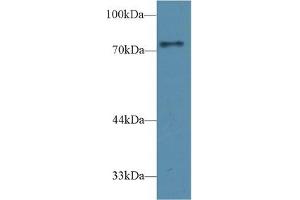 Detection of CD2AP in Rat Cerebrum lysate using Polyclonal Antibody to CD2 Associated Protein (CD2AP) (CD2AP 抗体  (AA 368-623))