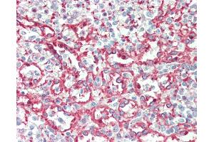 Anti-ITGA2B / CD41 antibody IHC staining of human spleen. (Integrin Alpha2b 抗体  (AA 122-171))