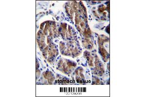 RPS4Y1 Antibody immunohistochemistry analysis in formalin fixed and paraffin embedded human stomach tissue followed by peroxidase conjugation of the secondary antibody and DAB staining. (RPS4Y1 抗体  (AA 76-105))