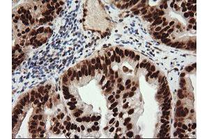 Image no. 8 for anti-Tripartite Motif Containing 38 (TRIM38) (AA 1-265) antibody (ABIN1490681)