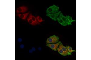 ABIN6257808 and ABIN6275782 staining Hela cells by IF/ICC.