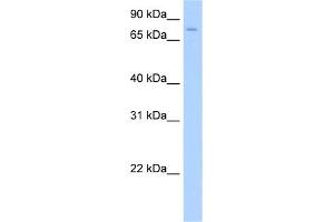 WB Suggested Anti-SV2A Antibody Titration:  0. (SV2A 抗体  (Middle Region))