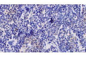 Immunohistochemistry (IHC) image for anti-Interleukin 10 (IL10) (AA 19-178) antibody (ABIN7428521)
