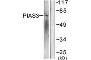 Western blot analysis of extracts from 293 cells, treated with UV 5', using PIAS3 Antibody. (PIAS3 抗体  (AA 10-59))