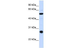 WB Suggested Anti-C6orf113 Antibody Titration:  0. (ZUFSP 抗体  (C-Term))