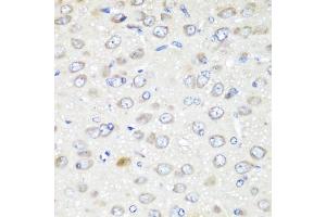 Immunohistochemistry of paraffin-embedded rat brain using G antibody (ABIN6129967, ABIN6140880, ABIN6140881 and ABIN6223736) at dilution of 1:200 (40x lens). (GABARAPL2 抗体  (AA 1-117))