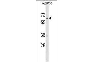 Western blot analysis in A2058 cell line lysates (35ug/lane). (TRIM35 抗体  (C-Term))