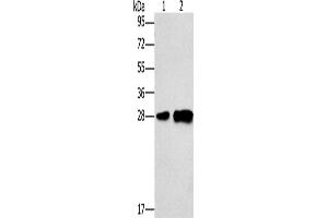 Western Blotting (WB) image for anti-Lymphocyte Antigen 96 (LY96) antibody (ABIN5544227) (LY96 抗体)