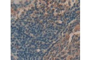 IHC-P analysis of Human Tissue, with DAB staining. (IL-21 抗体  (AA 23-155))