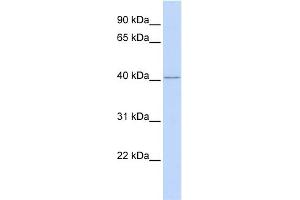 WB Suggested Anti-RING1 Antibody Titration:  0. (RING1 抗体  (Middle Region))