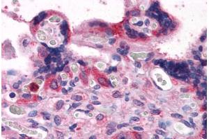 Human Placenta: Formalin-Fixed, Paraffin-Embedded (FFPE) (BAG3 抗体  (AA 563-575))