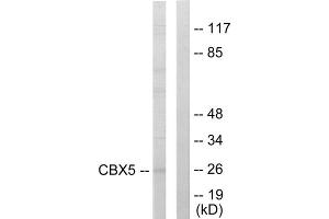 Western blot analysis of extracts from HUVEC cells, using CBX5 antibody. (CBX5 抗体  (Internal Region))