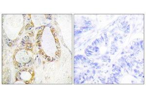 Immunohistochemistry (IHC) image for anti-Mucin 13, Cell Surface Associated (MUC13) (C-Term) antibody (ABIN1849970) (MUC13 抗体  (C-Term))