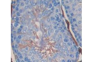 Used in DAB staining on fromalin fixed paraffin- embedded Kidney tissue (Dickkopf-Like 1 (DKKL1) (AA 21-230) 抗体)