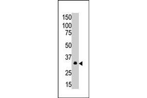 The MAGEA6 polyclonal antibody  is used in Western blot to detect MAGEA6 in A-549 cell lysate. (MAGEA6 抗体  (C-Term))
