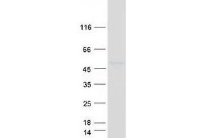 Western Blotting (WB) image for Interleukin 5 Receptor, alpha (IL5RA) (Transcript Variant 3) protein (Myc-DYKDDDDK Tag) (ABIN2713397)