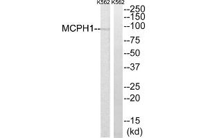 Western blot analysis of extracts from K562 cells, using MCPH1 antibody. (MCPH1 抗体  (N-Term))