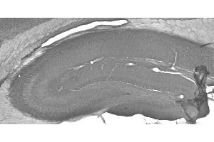 Adult rat hippocampus immunohistochemistry.
