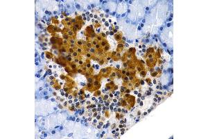Immunohistochemistry of paraffin-embedded rat pancreas using MT2A antibody (ABIN1873764) at dilution of 1:200 (40x lens). (MT2A 抗体)