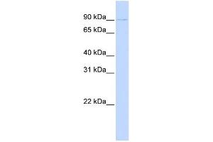 WB Suggested Anti-PRDM13 Antibody Titration:  0. (PRDM13 抗体  (N-Term))