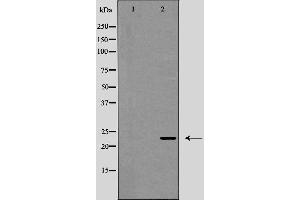 Western blot analysis of Interleukin 12A expression in HeLa cells,The lane on the left is treated with the antigen-specific peptide. (IL12A 抗体  (Internal Region))