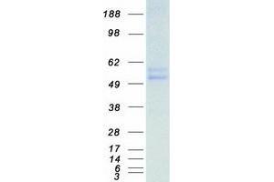 Western Blotting (WB) image for Tripartite Motif Containing 21 (TRIM21) protein (Myc-DYKDDDDK Tag) (ABIN2732675)