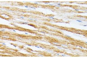 Immunohistochemistry of paraffin-embedded Rat heart using TPM2 Polyclonal Antibody at dilution of 1:100 (40x lens). (TPM2 抗体)