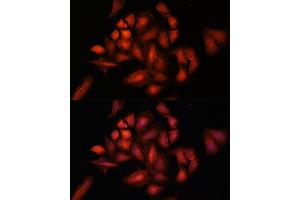 Immunofluorescence (IF) image for anti-Signal Transducing Adaptor Molecule (SH3 Domain and ITAM Motif) 2 (STAM2) (AA 376-525) antibody (ABIN6148550)