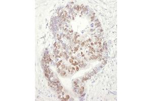 Immunohistochemistry (IHC) image for anti-Minichromosome Maintenance Complex Component 3 (MCM3) (AA 500-550) antibody (ABIN7449378) (MCM3 抗体  (AA 500-550))