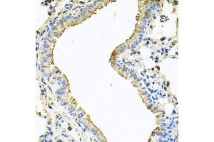 Immunohistochemistry of paraffin-embedded mouse lung using CHCHD3 antibody (ABIN5995784) at dilution of 1/100 (40x lens). (CHCHD3 抗体)
