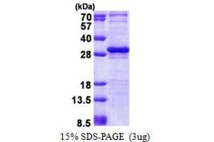 SDS-PAGE (SDS) image for Layilin (LAYN) (AA 22-235) protein (His tag) (ABIN5853136)