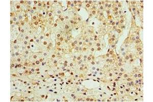 Immunohistochemistry of paraffin-embedded human adrenal gland tissue using ABIN7144558 at dilution of 1:100 (ADAP1 抗体  (AA 1-374))