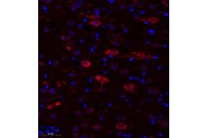 Immunofluorescence of paraffin embedded rat corpus striatum using TTC33 (ABIN7075871) at dilution of 1: 650 (300x lens) (TTC33 抗体)
