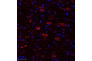 Immunofluorescence of paraffin embedded rat corpus striatum using TTC33 (ABIN7075871) at dilution of 1: 650 (300x lens) (TTC33 抗体)