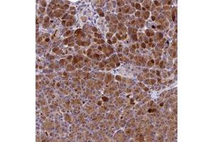 Immunohistochemical staining of human pancreas with PZP polyclonal antibody  shows strong cytoplasmic positivity in exocrine glandular cells at 1:10-1:20 dilution. (PZP 抗体)