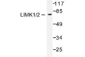 Image no. 1 for anti-LIM Domain Kinase 1 (LIMK1) antibody (ABIN265508) (LIM Domain Kinase 1 抗体)